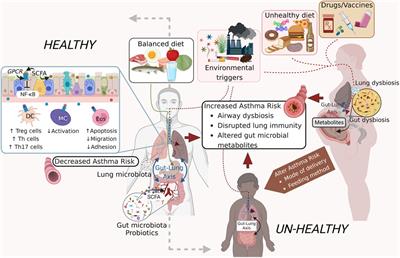 Human matters in asthma: Considering the microbiome in pulmonary health